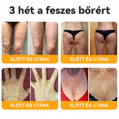 🌿 VLSVLS® Méhméreg Bőrhelyreállító Krém ✨ UTOLSÓ NAP – 80% KEDVEZMÉNY 🏆