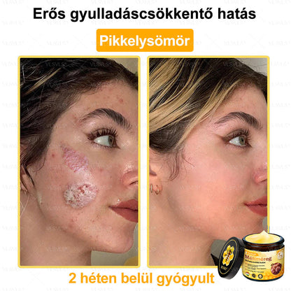 VLSVLS® Méhméreg Bőrhelyreállító Krém✅ – Utolsó nap! 80% kedvezmény 🔥