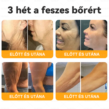 🌿 VLSVLS® Méhméreg Bőrhelyreállító Krém ✨ UTOLSÓ NAP – 80% KEDVEZMÉNY 🏆