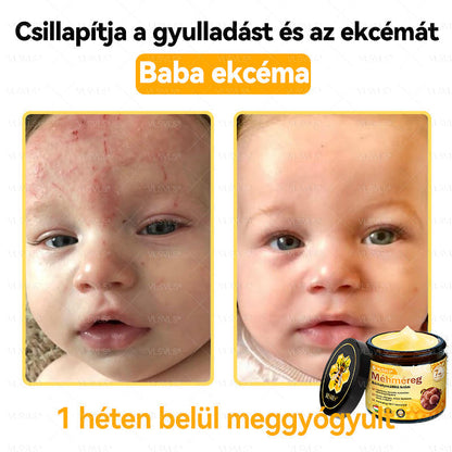 VLSVLS® Méhméreg Bőrhelyreállító Krém✅ – Utolsó nap! 80% kedvezmény 🔥