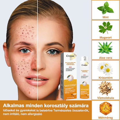 💎Cvreoz spray szemölcsök és anyajegyek eltávolítására méhméreggel (👨‍⚕DDG AJÁNLÁS)🐝🐝(🔥utolsó napi ajánlat 80% kedvezménnyel)