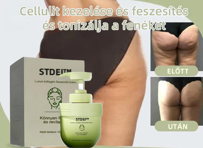 STDEI™ Luxus Kollagénfeszesítő Krém (🔥70% kedvezmény korlátozott ideig!)💥