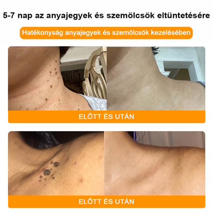 🐝💖 BSWELL® Méhméreg Krém 👨‍⚕️( AAD Ajánlásával )🔥 Utolsó nap: 80% Kedvezmény