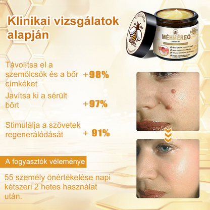 🐝💖 BSWELL® Méhméreg Krém 👨‍⚕️( AAD Ajánlásával )🔥 Utolsó nap: 80% Kedvezmény