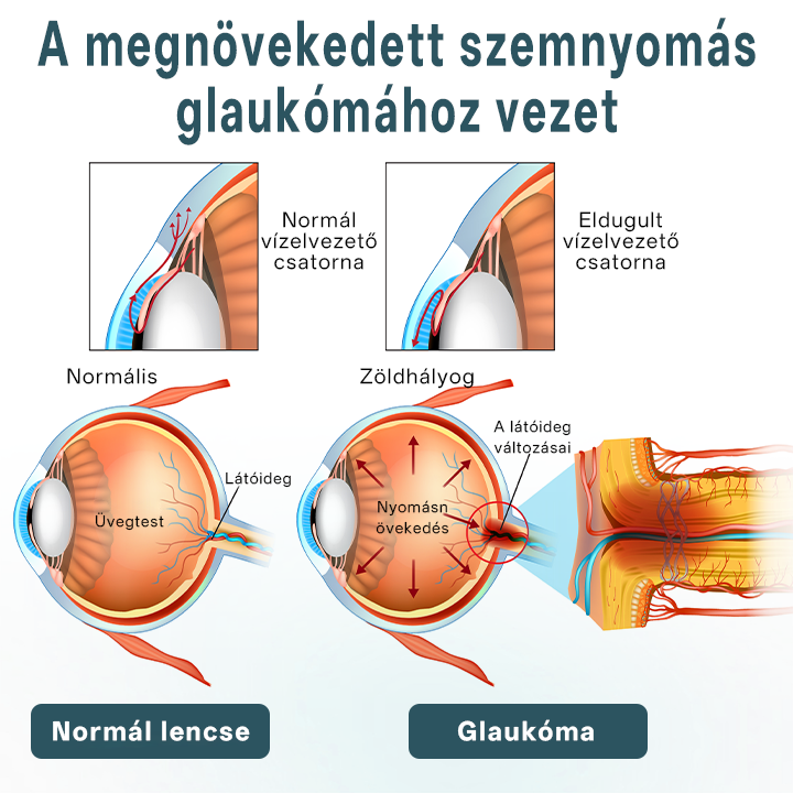 ✅Timilk® OptiFusion Nano szemcsepp szérum🌟